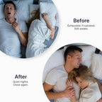 Anti Snore Mouthpiece For Sleep